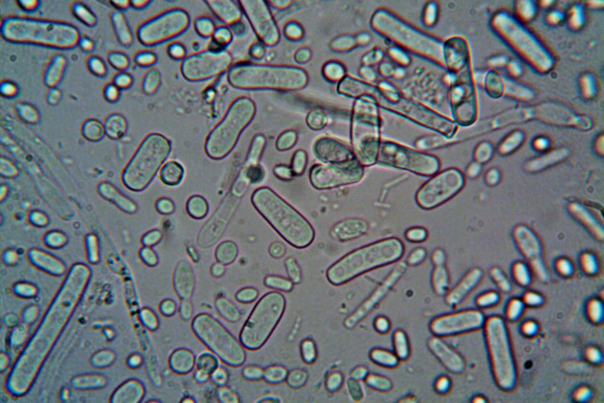 Close-up image of rod-shaped bacteria under a microscope, showcasing microscopic detail.